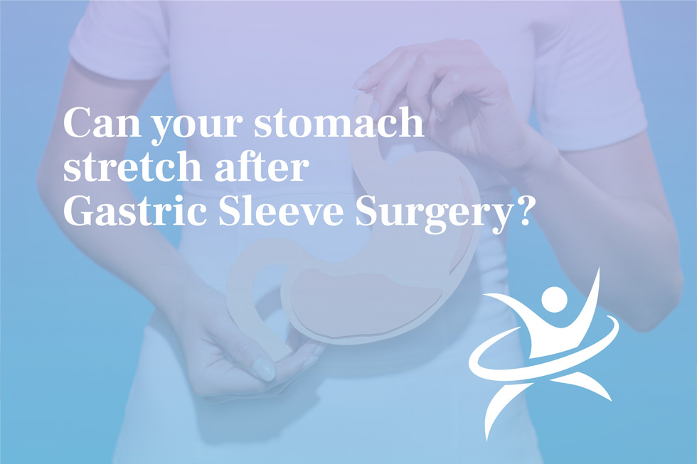 Can your stomach stretch after Gastric Sleeve Surgery?