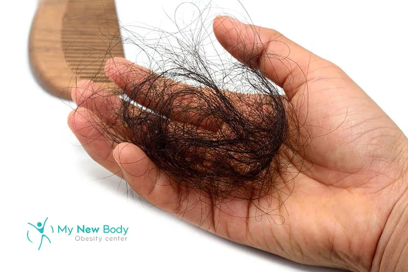 Will I lose hair after Bariatric Surgery?