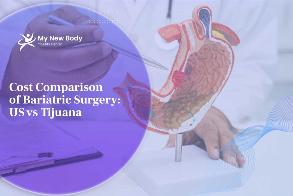 Cost Comparison of Bariatric Surgery