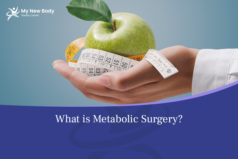 Metabolic Surgery