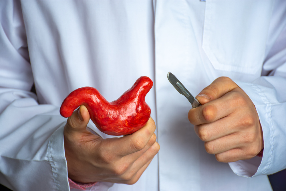 benefits of gastric sleeve